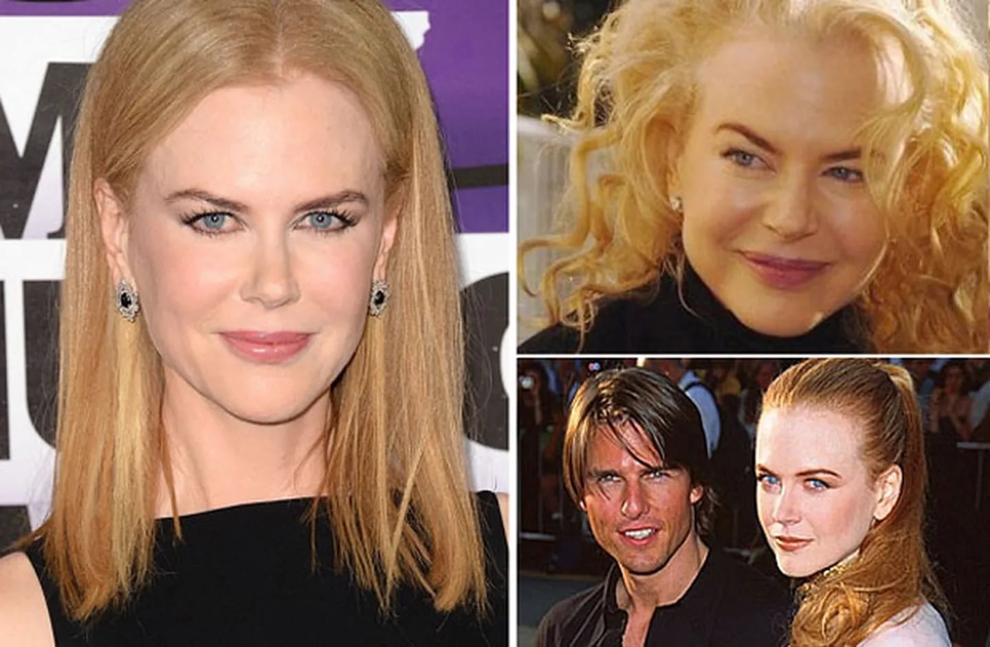 Nicole Kidman se arrepiente de haber usado bótox y… ¿de Tom Cruise? (Foto: Web)