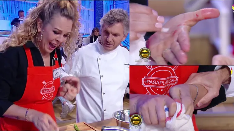 Yanina Screpante se accidentó en Pasaplatos Famosos: se cortó la mano y debió cocinar con un guante 