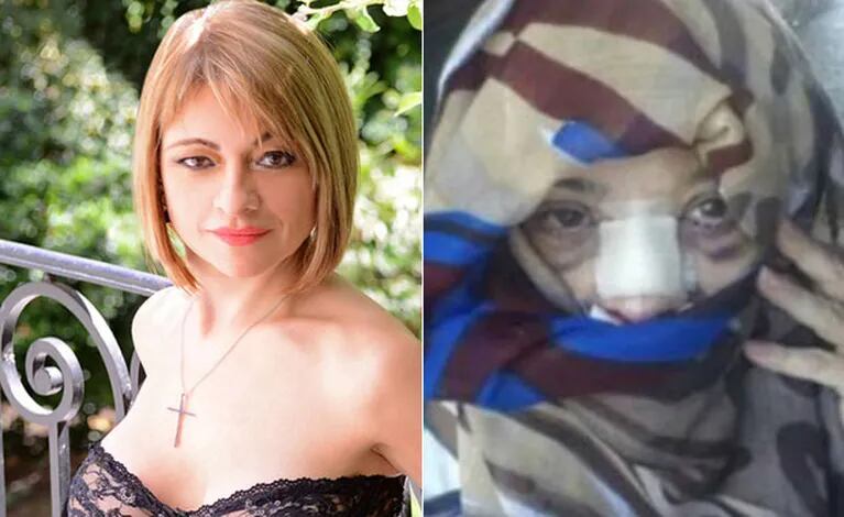 Marcela Feudale, tras la difusión de su foto recién operada: "Era una selfie en la que me hice la Sherezade, fue con humor" (Foto: Ciudad.com y Web)