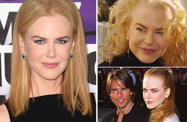 Nicole Kidman se arrepiente de haber usado bótox y… ¿de Tom Cruise? (Foto: Web)