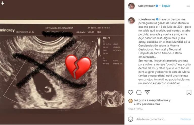 El dolor de Sol Estevanez al revelar que perdió un bebé tres meses atrás: "Mi embarazo de 9 semanas se había detenido sin razón alguna"