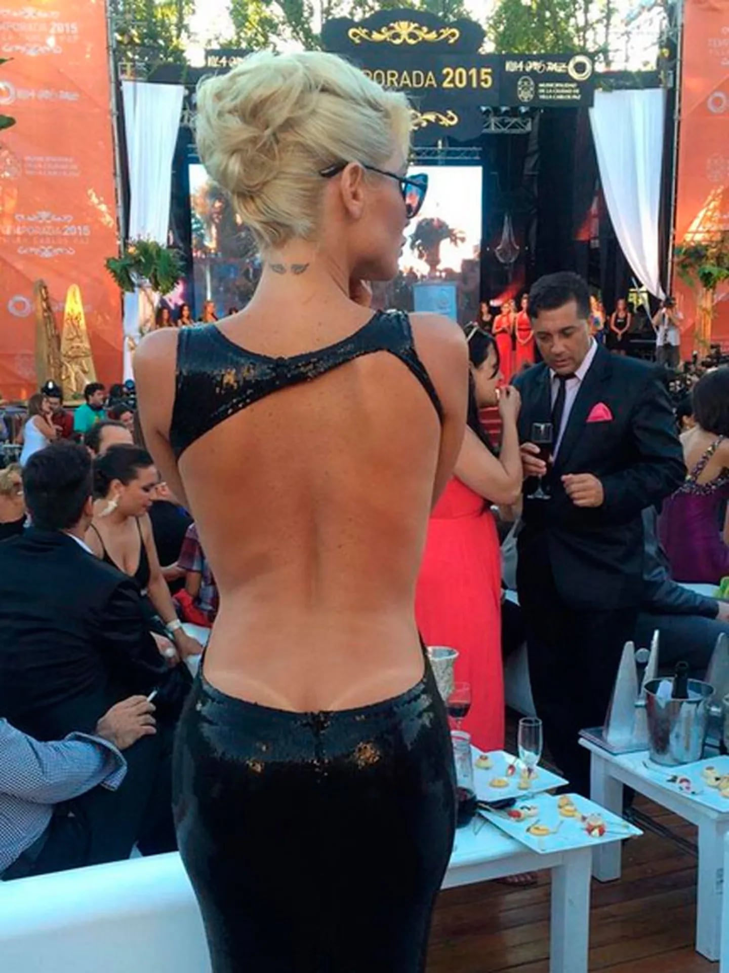 Vicky Xipolitakis mostró con orgullo la marca que le dejó el sol en la espalda. (Foto: Twitter)