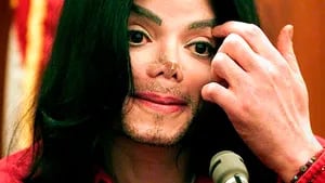Revelan datos sobre la autopsia de Michael Jackson: estaba calvo y su cuerpo repleto de cortes y cicatrices