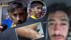 Así quedó Pablo Pérez, el capitán de Boca, luego del ataque al micro que trasladaba a los jugadores al Monumental