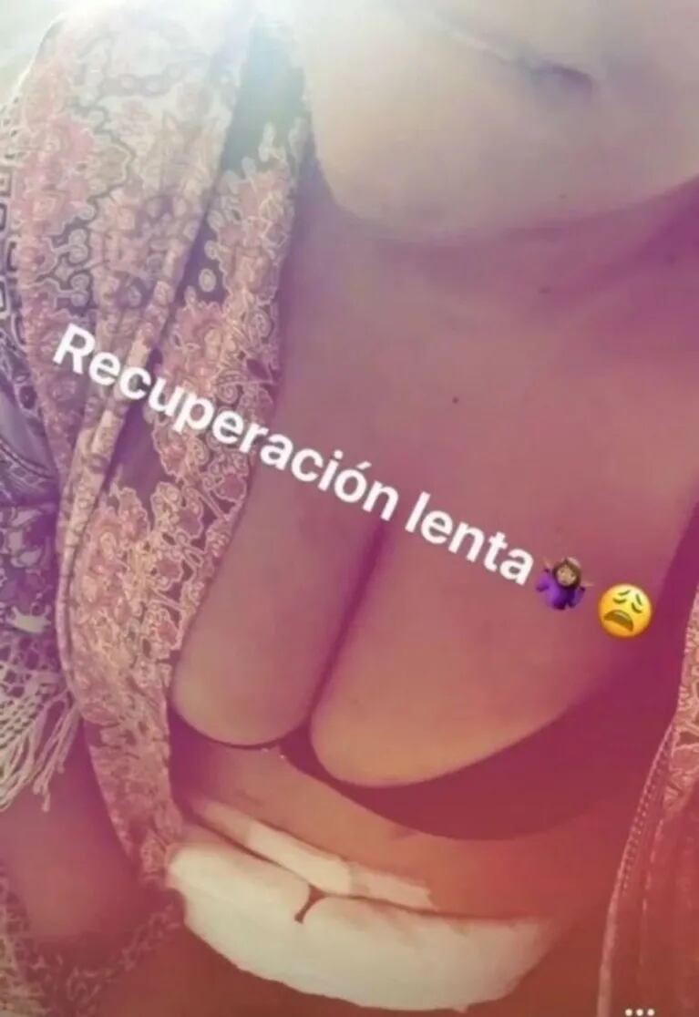 Morena Rial y su selfie de post operatorio, tras su cirugía reconstructiva: "Recuperación lenta"