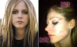 Avril Lavingne antes y después de la brutal agresión. (Foto: Web)
