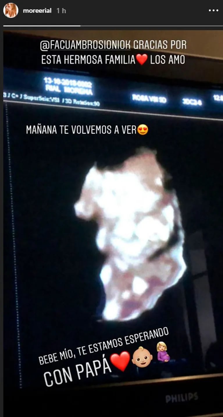 Morena Rial mostró la ecografía de su bebé, embarazada de cuatro meses: "Con papá te estamos esperando"