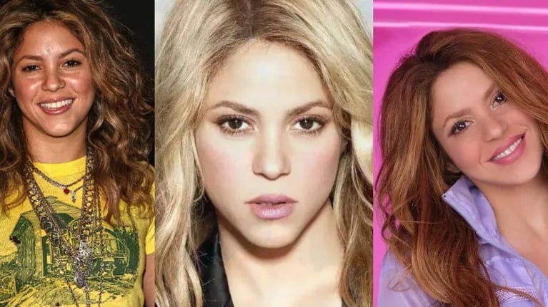 Las 4 operaciones estéticas de Shakira que ni imaginabas.