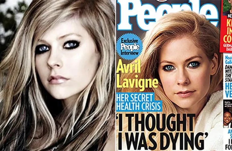 Avril Lavigne habló de la enfermedad de Lyme. (Fotos: Web y revista People)