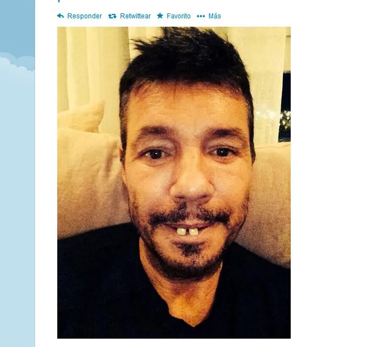 Marcelo Tinelli bromeó con su nuevo "look" tras ir al dentista. (Foto: Twitter)