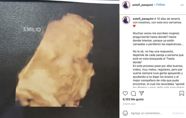 Estefanía Pasquini mostró en una eco la carita del bebé que espera con Alberto Cormillot: "A días de conocerte"