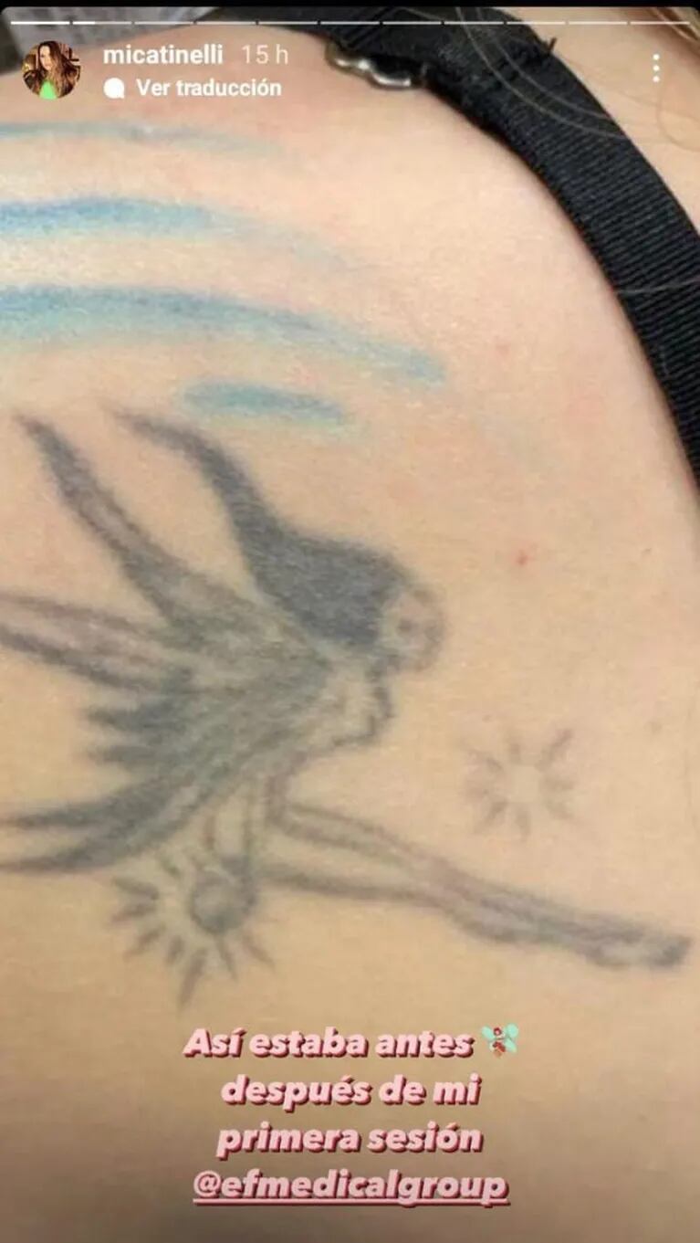 Mica Tinelli se empezó a borrar los tatuajes: "No entiendo en qué momento decidí hacerme esto"
