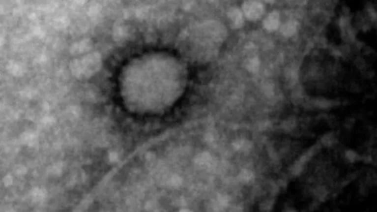 Se conoció la primera imagen del coronavirus que circula en Argentina. 