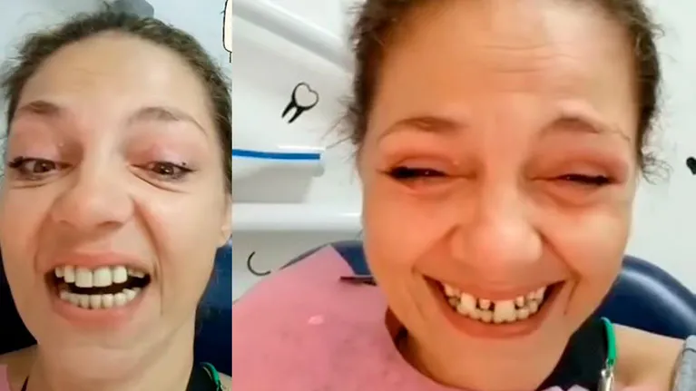 Tamara Paganini mostró un video con el nuevo tratamiento de su dentadura