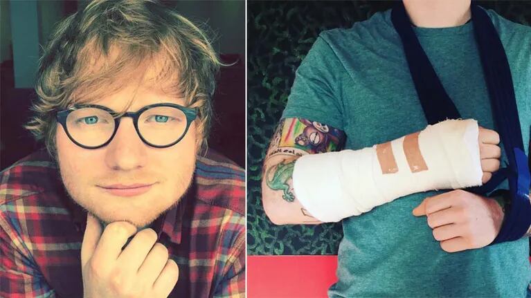 Ed Sheeran chocó con su bicicleta en Londres y peligra su gira por Asia