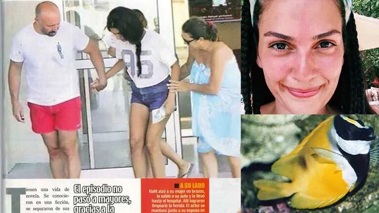 Bergüzar Korel fue mordida por un pez conejo en el Mar Egeo. (Foto: revista Paparazzi)