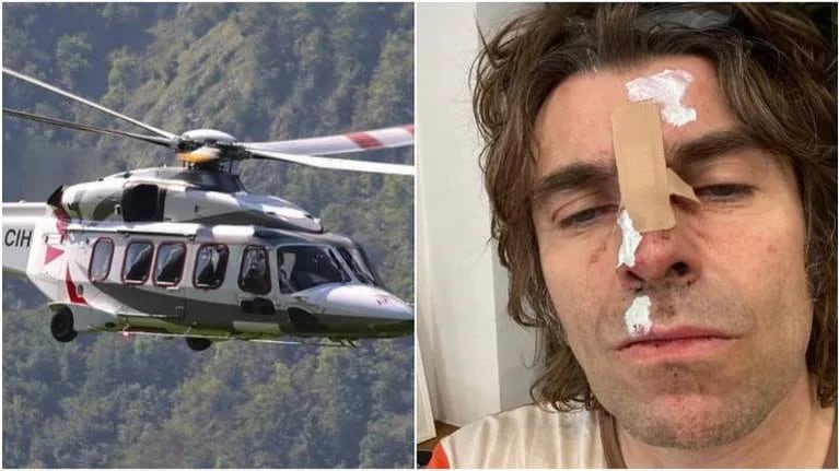 El misterio de Liam Gallagher: apareció herido tras caer de un helicóptero