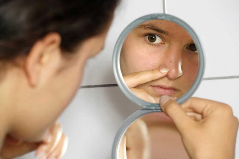  11 consejos útiles para evitar el acné