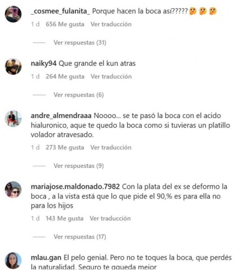 A Camila Homs la fulminaron por su último retoque estético: "Se deformó"