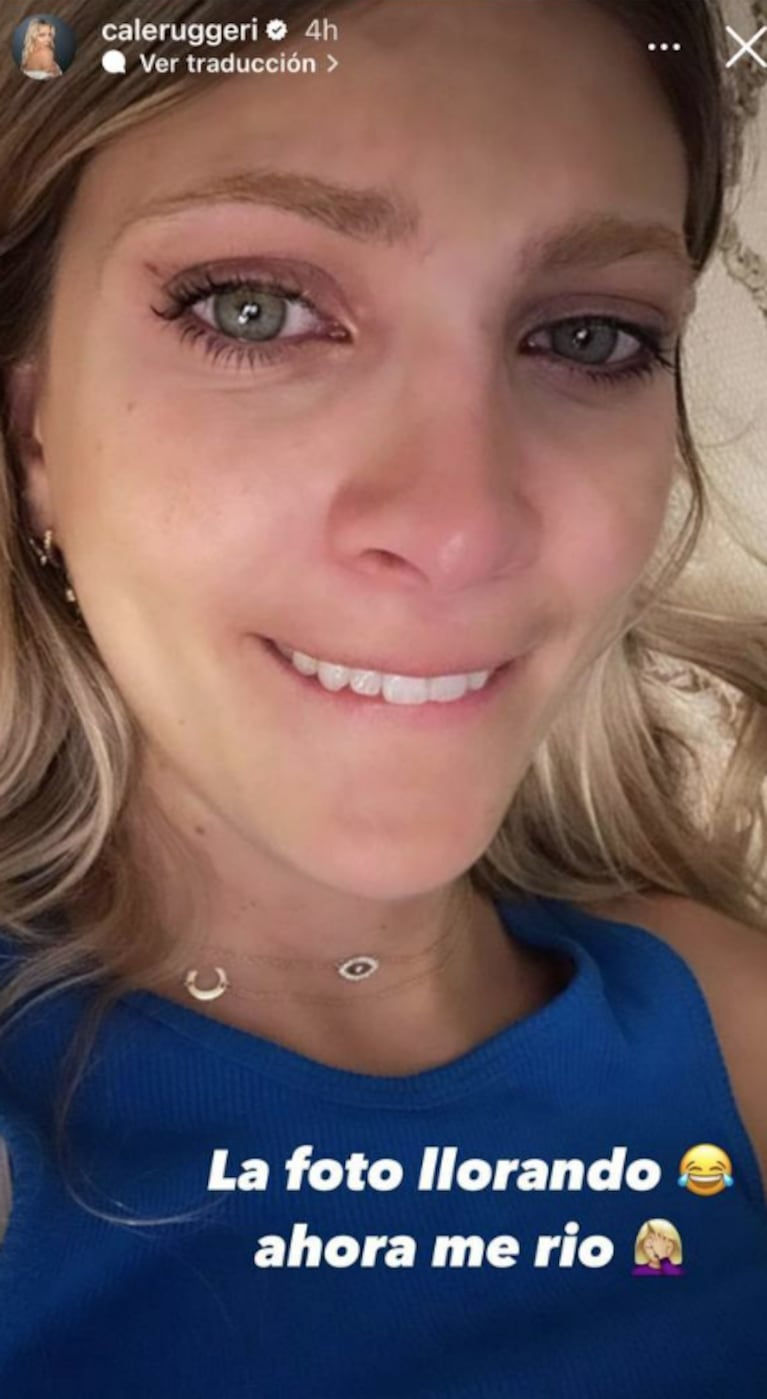 A Cande Ruggeri se le partió un diente y compartió las fotos llorando desesperada antes del arreglo