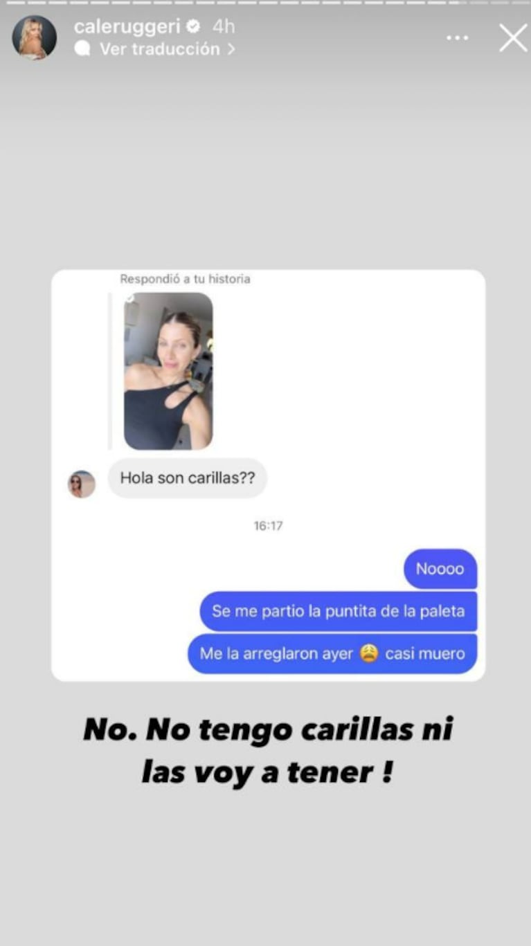 A Cande Ruggeri se le partió un diente y compartió las fotos llorando desesperada antes del arreglo