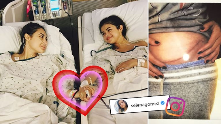 ¡Acto de amor! Selena Gomez se sometió a un trasplante de riñón y la donante fue su mejor amiga