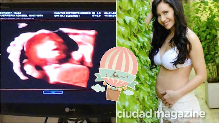 Adabel Guerrero mostró la primera ecografía de su beba: "¡Les presento a Lola! Emoción, amor, sin palabras" Foto: Ciudad/ Instagram