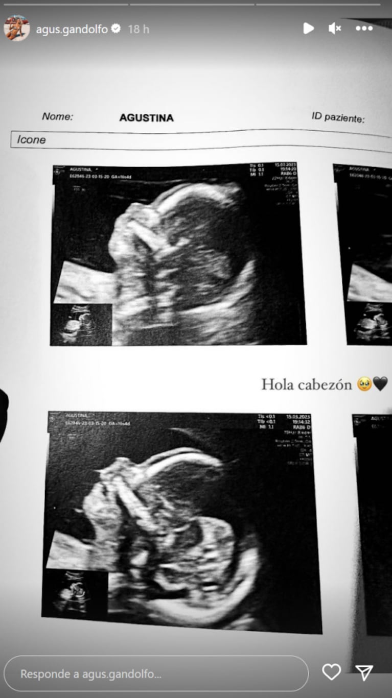 Agustina Gandolfo, la novia de Lautaro Martínez, compartió la primera ecografía de su bebé en camino: "Cabezón"