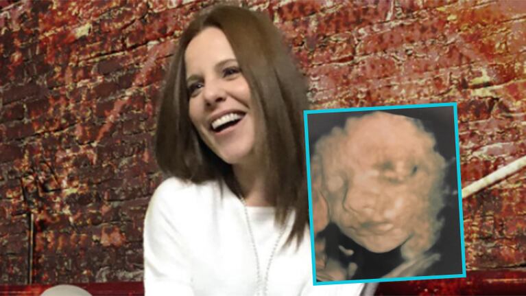 Agustina Kämpfer, emocionada por la eco 4D de su bebé  (Fotos: Instagram).