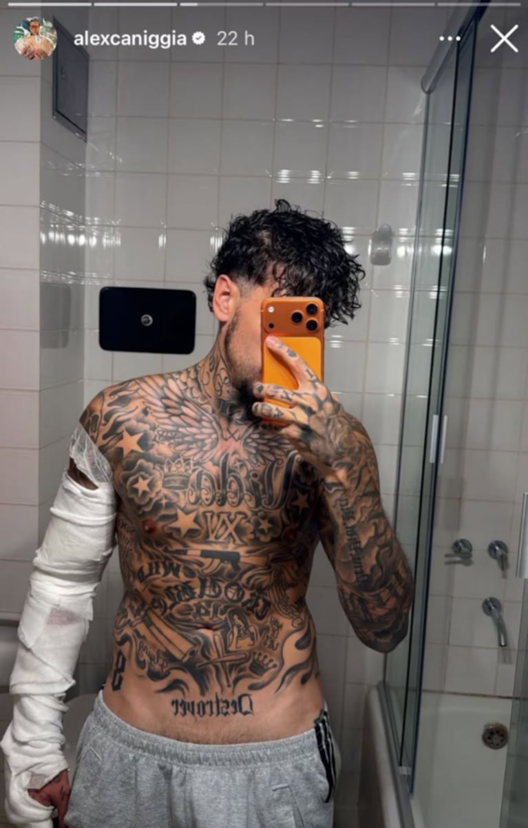 Alex Caniggia mostró su impactante cambio físico: qué pasará con sus tatuajes | Créditos: Instagram @alexcaniggia