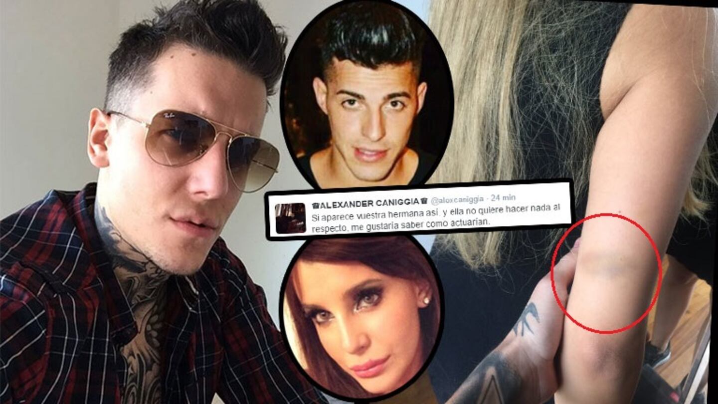 Alex Caniggia mostró una foto de Charlotte golpeada (Foto: Twitter)