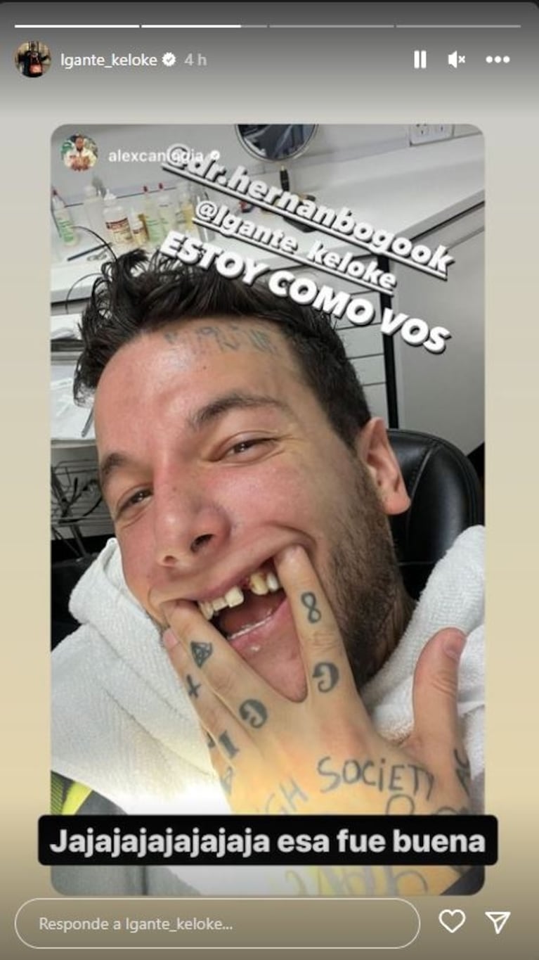 Alex Caniggia se burló de los dientes de L-Gante y recibió una rápida respuesta