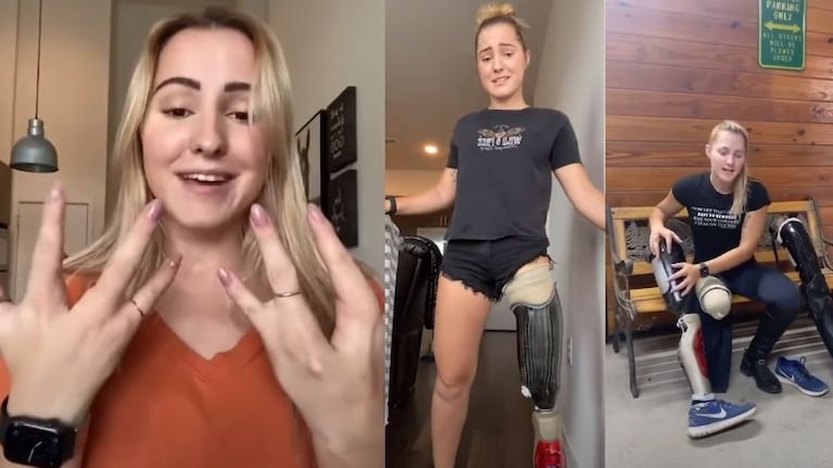 Alyssa Cleland inspira con su historia: nació con una rara condición, tiene una pierna amputada y la abandonaron de bebé