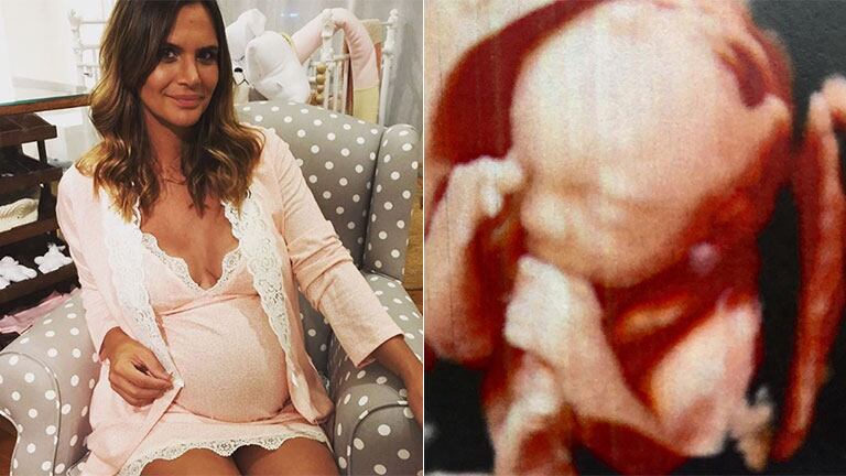 Amalia Granata ya tiene padrino para su bebé (Foto: Instagram)
