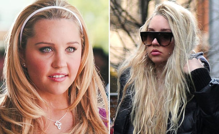 Amanda Bynes, internada en un hospital psiquiátrico. (Foto: Web)