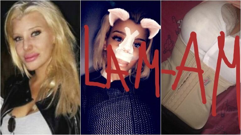 Ángel de Brito reveló fotos del postoperatorio de Charlotte Caniggia tras pasar por el quirófano: "Se operó la nariz y las lolas". Foto: Twitter