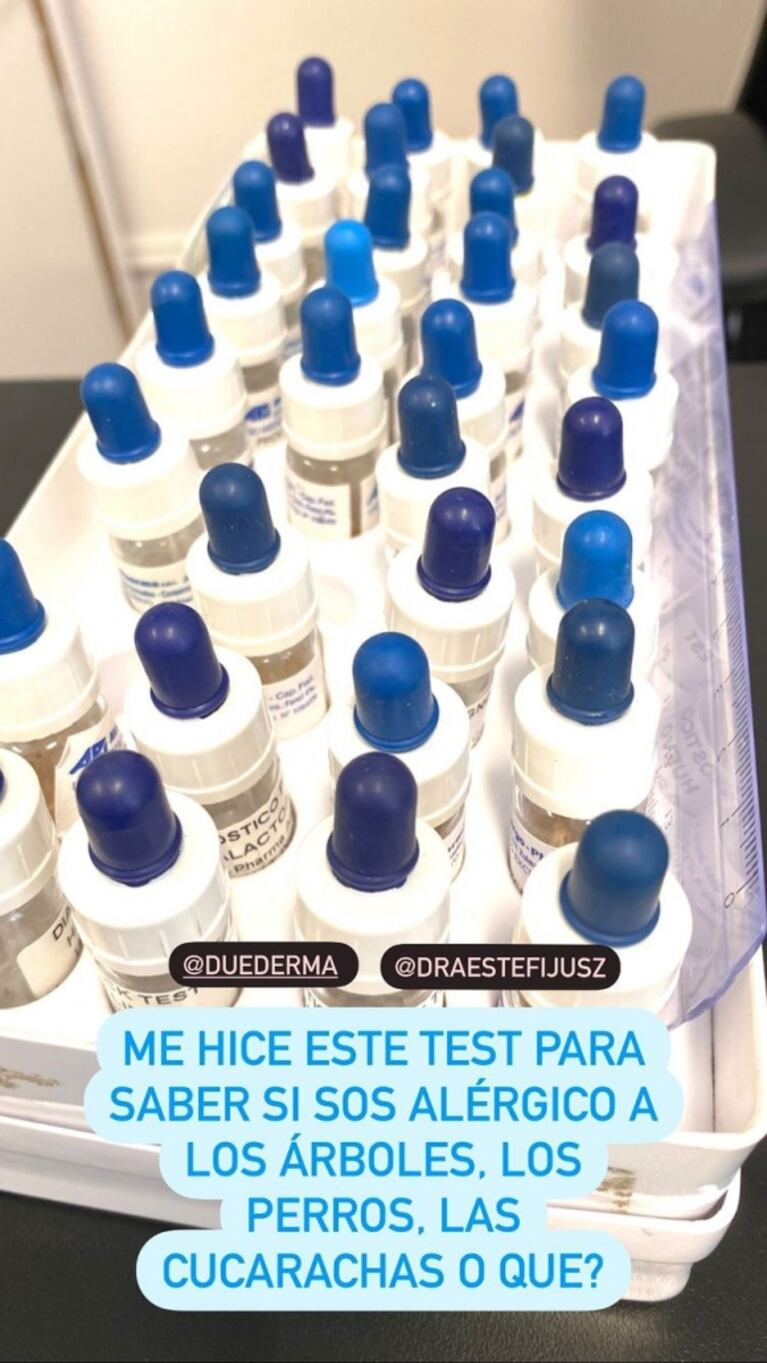Ángel de Brito se hizo un test para saber a qué es alérgico y compartió su sorpresa: "¡Son un asco los ácaros!"
