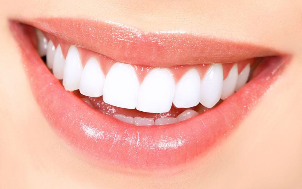 Aprendé cómo eliminar el sarro y blanquear tus dientes