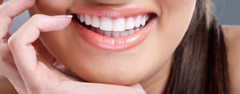Aprendé un poco más sobre las carillas dentales, la moda del siglo XXI
