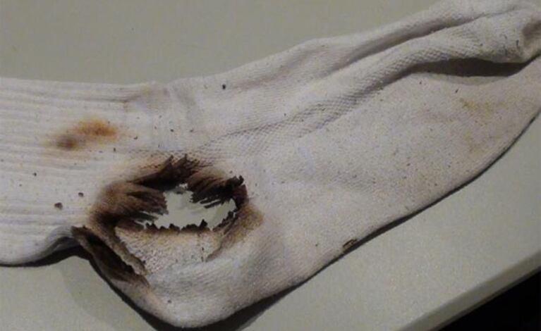 Así quedaron las medias de Mario Perolini. (Foto: Twitter)