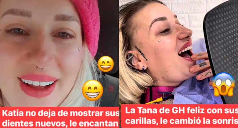 Así quedó Katia "La Tana" de Gran Hermano  (Foto: Instagram @nersotv)