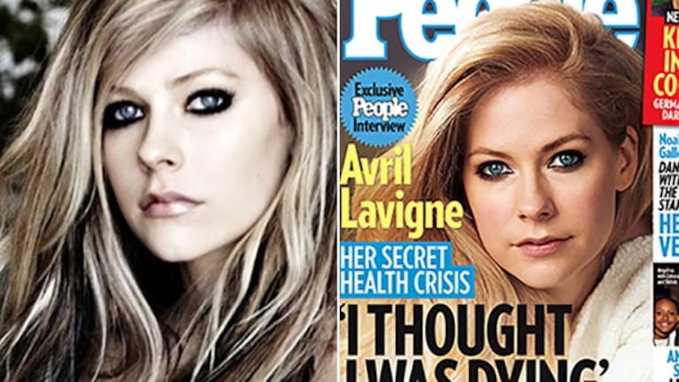 Avril Lavigne habló de la enfermedad de Lyme. (Fotos: Web y revista People)