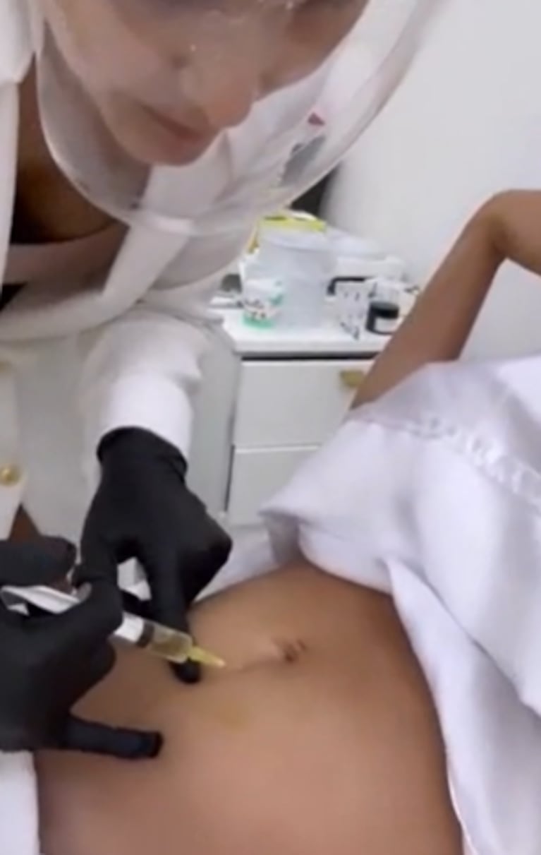 Barby Franco mostró el tratamiento estético que se hizo tras el parto de Sarah Burlando: rostro, abdomen y cicatrices