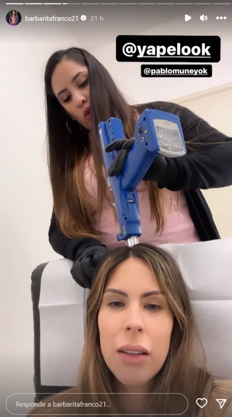 Barby Franco mostró qué tratamiento capilar empezó para luchar contra la caída de su cabello: "No duele"