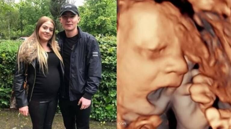 Bebé le hizo “fuck you” a sus padres durante una ecografía 4D