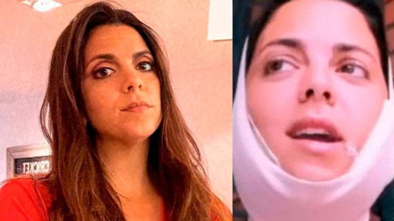 Belu Lucius se hizo una cirugía estética y mostró las fotos de su recuperación.