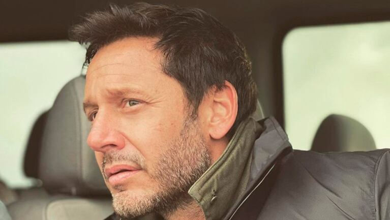 Benjamín Vicuña impactó con esta foto con el rostro totalmente ensangrentado.