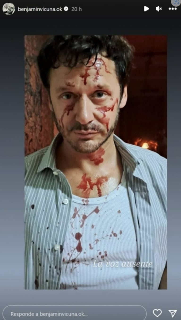 Benjamín Vicuña impactó con una foto con el rostro totalmente ensangrentado