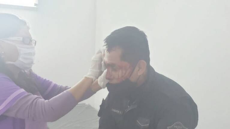 Brutal golpiza a policías que intentaron interrumpir un campeonato de fútbol en Salta 