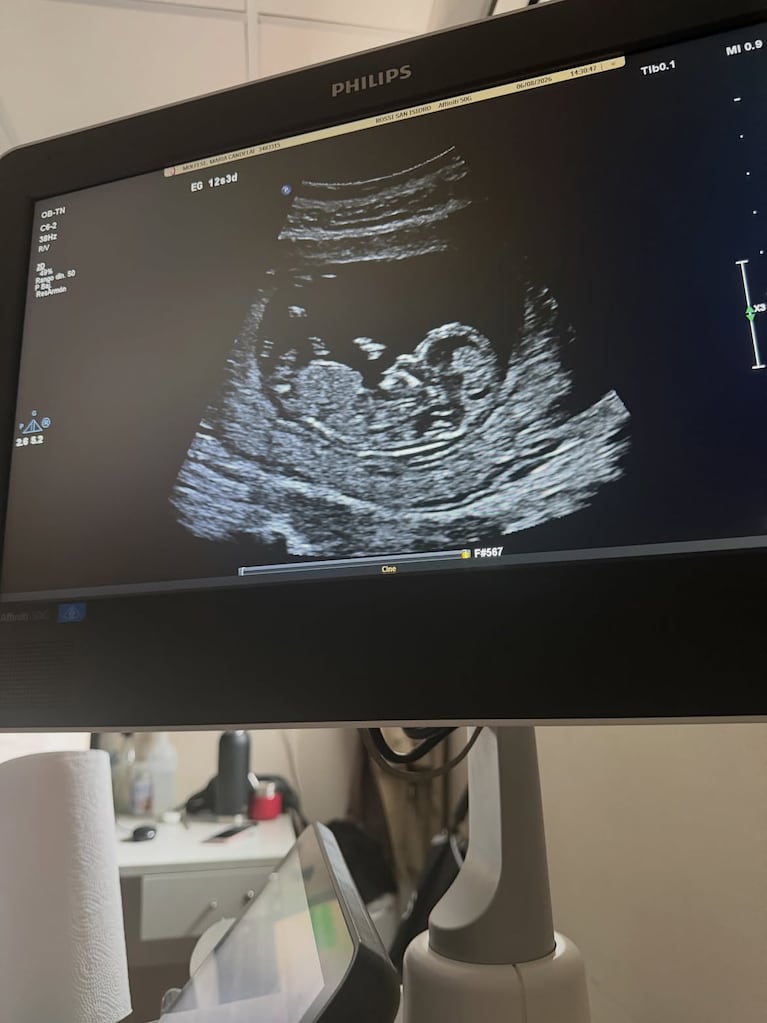 Cande Molfese está embarazada de su primer hijo: “Ahora somos cinco”